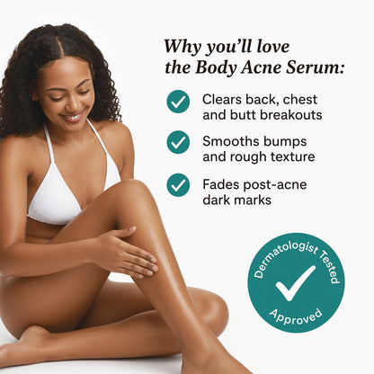 Bare & Bold Body Acne Serum 15% Mandelic Acid